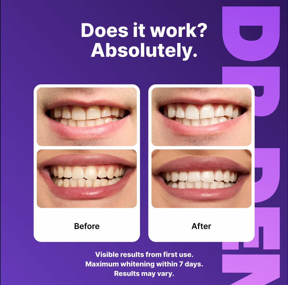Teeth Whitening Strips